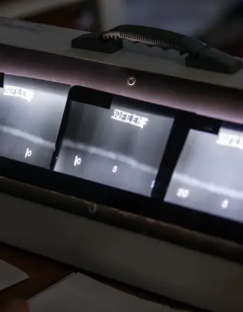 Radyografik Muayene (RT)